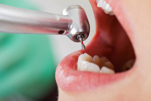 Best Pediatric Emergency Dentist in Carthage, NY